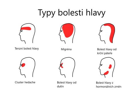Ilustrácia príznakov únavy a bolesti hlavy