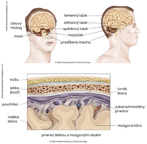 Ilustrácia šuškovitého telieska v mozgu