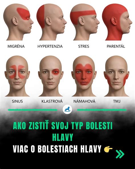 Ilustrácia hlavy s pulzujúcou bolesťou