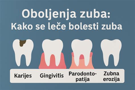 Ilustrácia pokazeného zuba