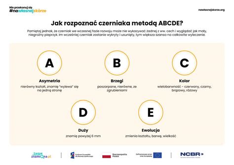 Infografika s pravidlom ABCDE