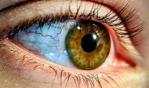 Diagram znázorňujúci ľudské oko s prepojením na energetické polia