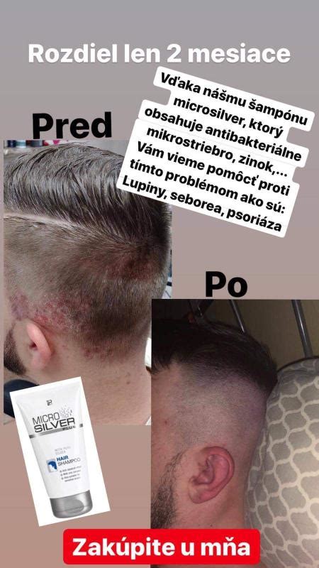 Zobrazenie troch Fúrií s hadmi vo vlasoch a bičmi