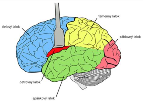 Ilustrácia mozgu s iskrami