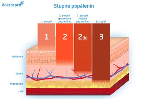 Diagram znázorňujúci stupne mimoriadneho pôsobenia zlého ducha