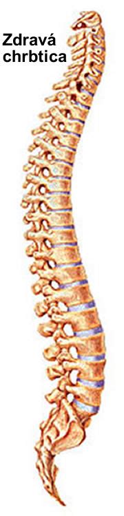 anatómia driekovej chrbtice a jej napojenie na panvu