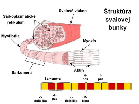 schéma poškodeného nervového vlákna a úbytku myelínu