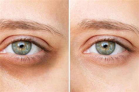 Dve osoby si pozerajú do očí s jemným úsmevom