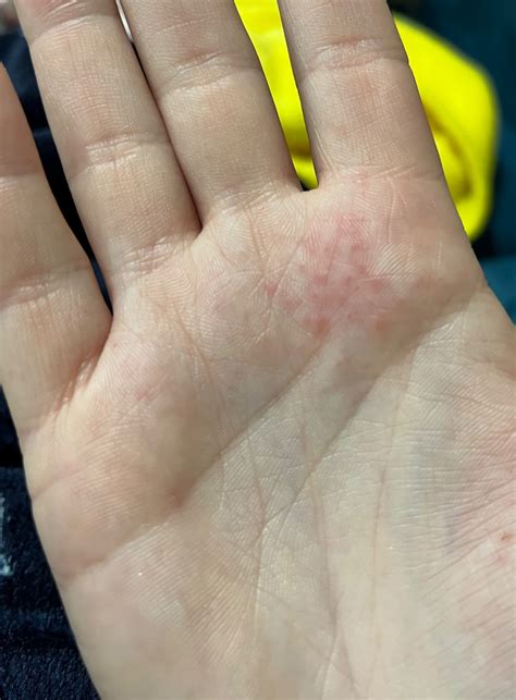 Ilustrácia hlavných čiar na dlani