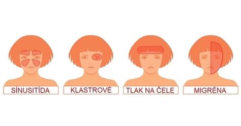 Ilustrácia znázorňujúca rôzne prejavy urieknutia, ako sú bolesti hlavy, únava a nervozita.