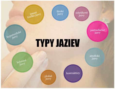 Obrázok znázorňujúci rôzne typy jaziev