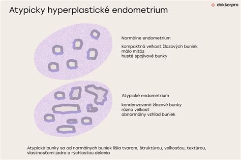 Ilustrácia hormonálneho systému